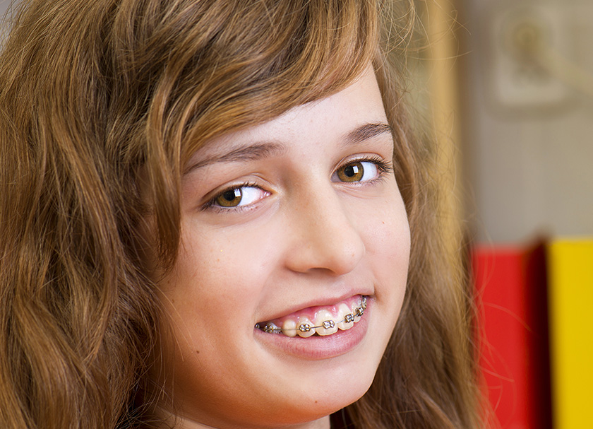 cost of dental braces in delhi